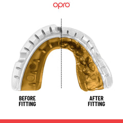 Opro Gold Braces Gumshield- White/Gold (Age 10+)