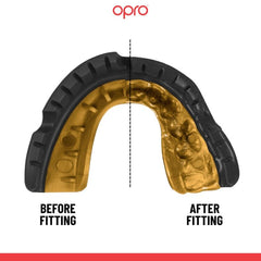 Opro Gold Braces Gumshield- Black/Gold (Age 10+)