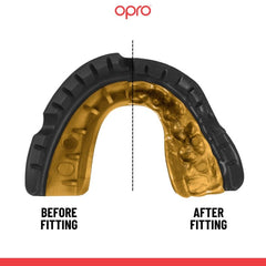 Opro Senior Gold Braces Gumshield- Black/Gold