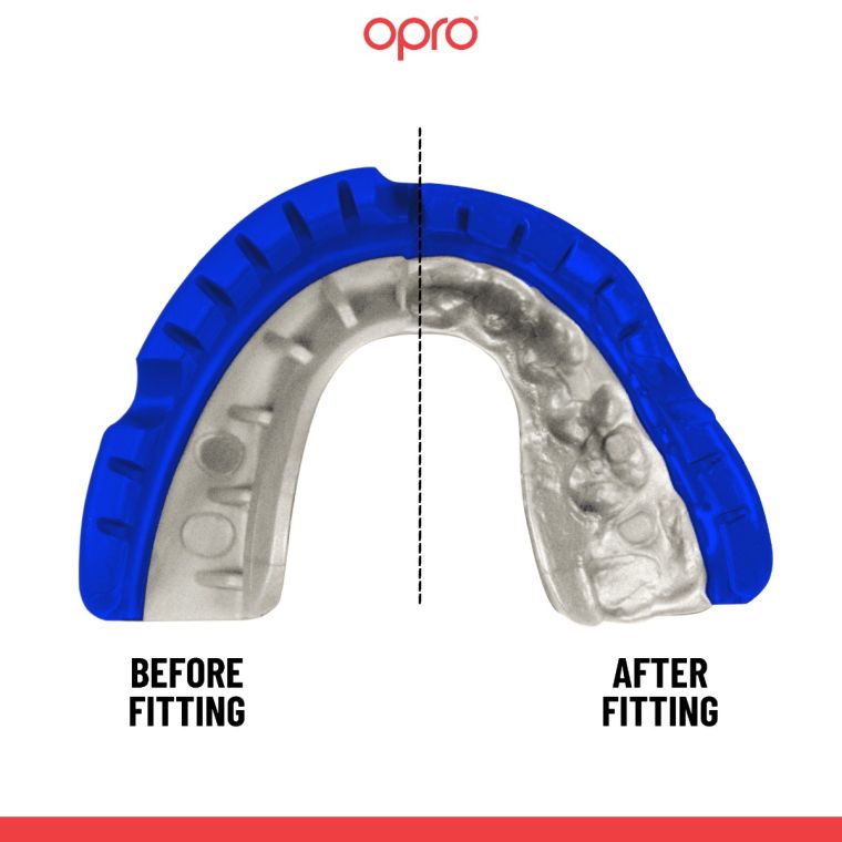 Opro Senior Gold Braces Gumshield- Blue