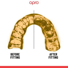 Opro Senior Custom Fit Gumshield- Gold/White